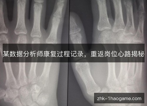 某数据分析师康复过程记录，重返岗位心路揭秘